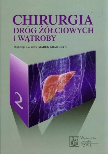 c6f2d70-chirurgia-drog-zolci.webp